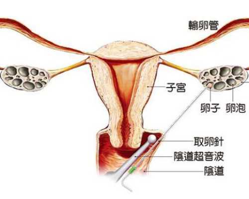 上海单身女性做供精试管婴儿费用明细表,上海第一人民医院做供精试管的成功
