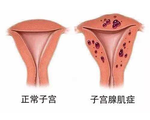 什么是可移植胚胎？