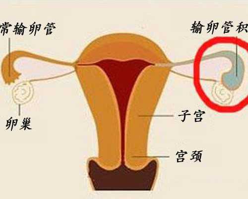 深圳助孕包男孩|绍兴供卵试管要多少钱？供卵试管会导致胎儿骤停吗？