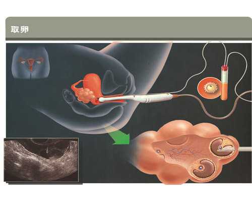 青岛三代试管婴儿医院,附青岛正规机构介绍