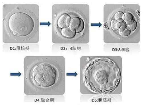 上海借卵生子成功率非常高_做试管的女性都比较焦虑鲜胚移植第二天会着床吗